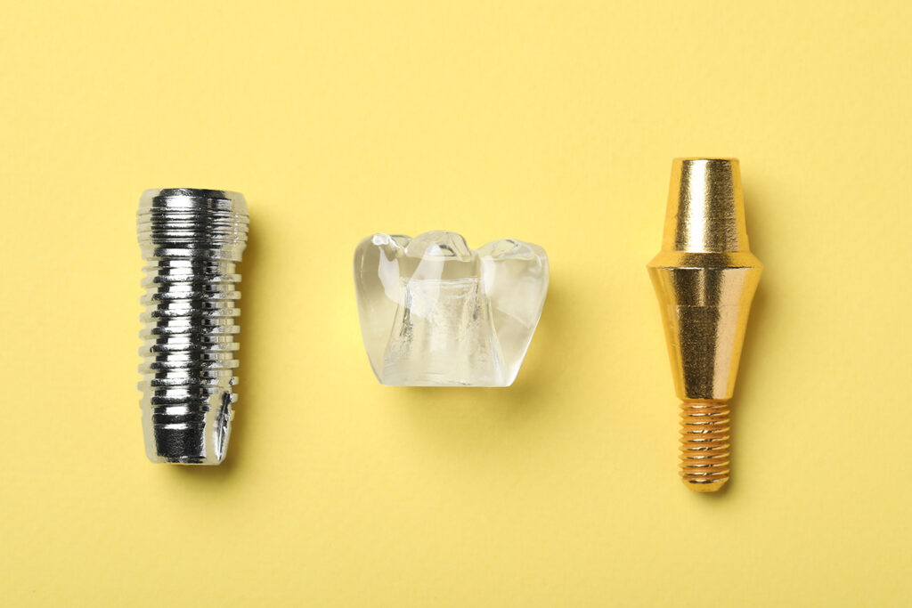 Parts of a dental implant: implant post, abutment and crown.