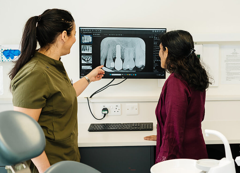 A female dental professional shows a patient a dental X-ray on a computer screen, highlighting a dental implant in the upper front teeth.