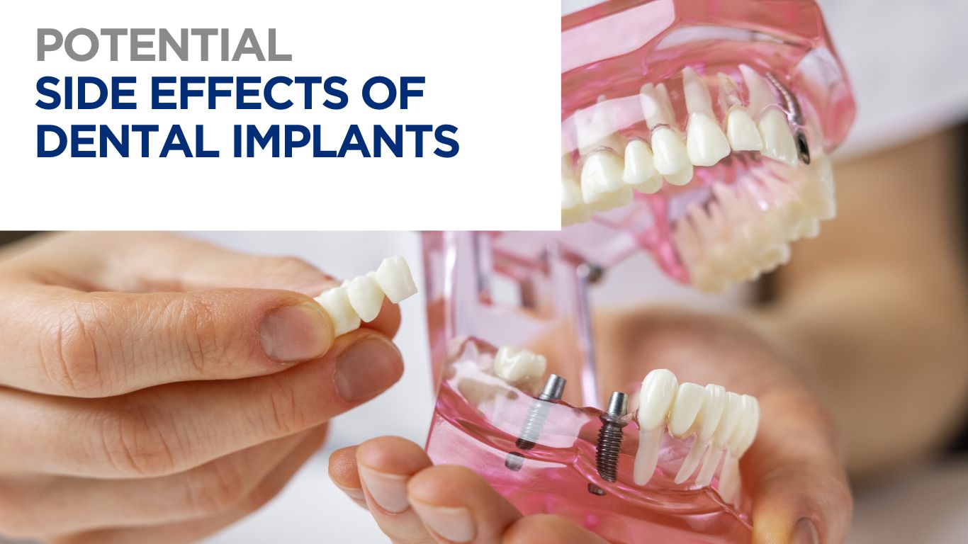 Close up of a typodont with two dental implants