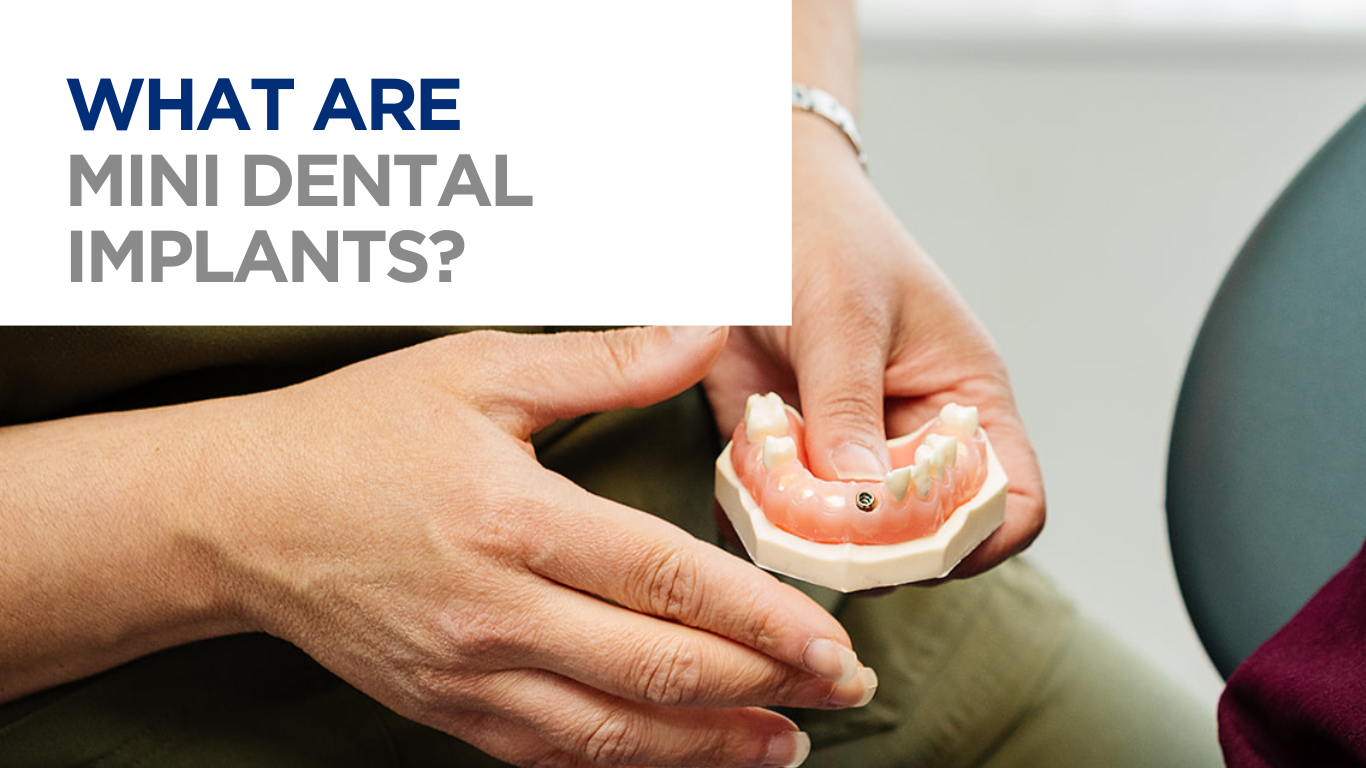 Dr Aileen Clack holding a mini dental implant typodont